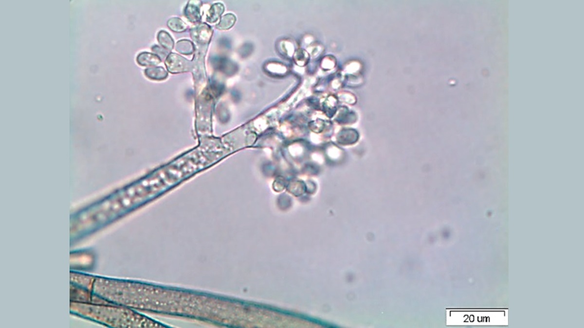 Botrytis cinere.jpg